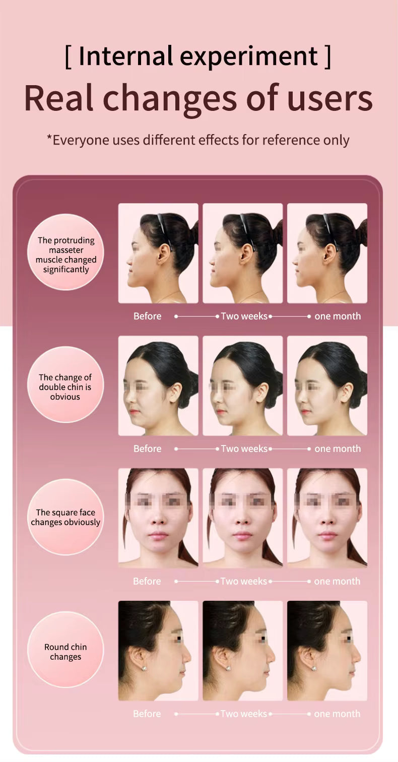 Facial Lifting & LED Photon Therapy Device – CAMMUO